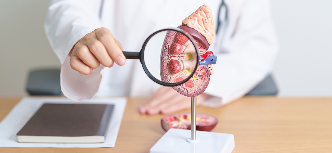 Os 5 estágios da doença renal crônica Clinirim Os 5 estágios da doença renal crônica Clinirim